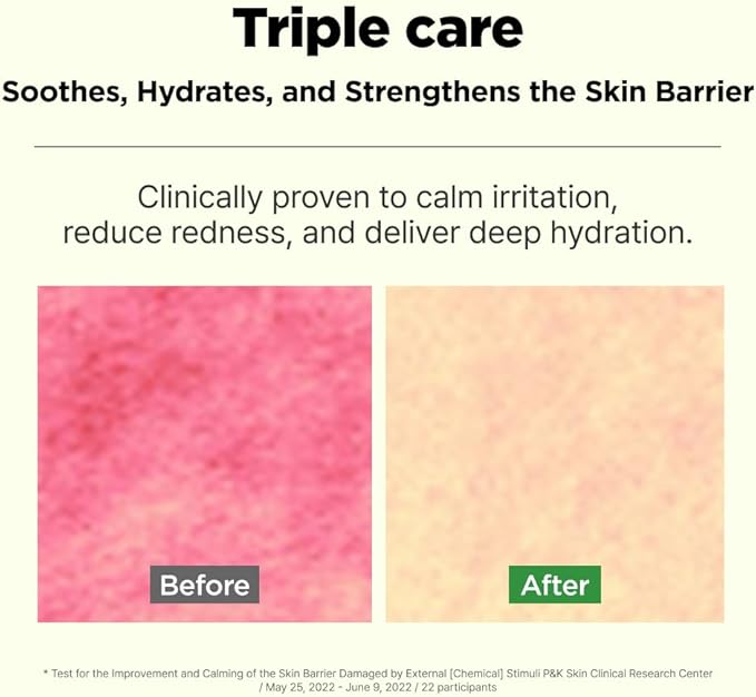 ISOI Moisture Dr. Soothing Toner, Lightweight Hydrating Toner with Tea Tree Ceramide & Hyaluronic Acid for Skin Barrier Support, Korean Skin Care (4.39 fl.oz/130ml)-FemmiqueWomen