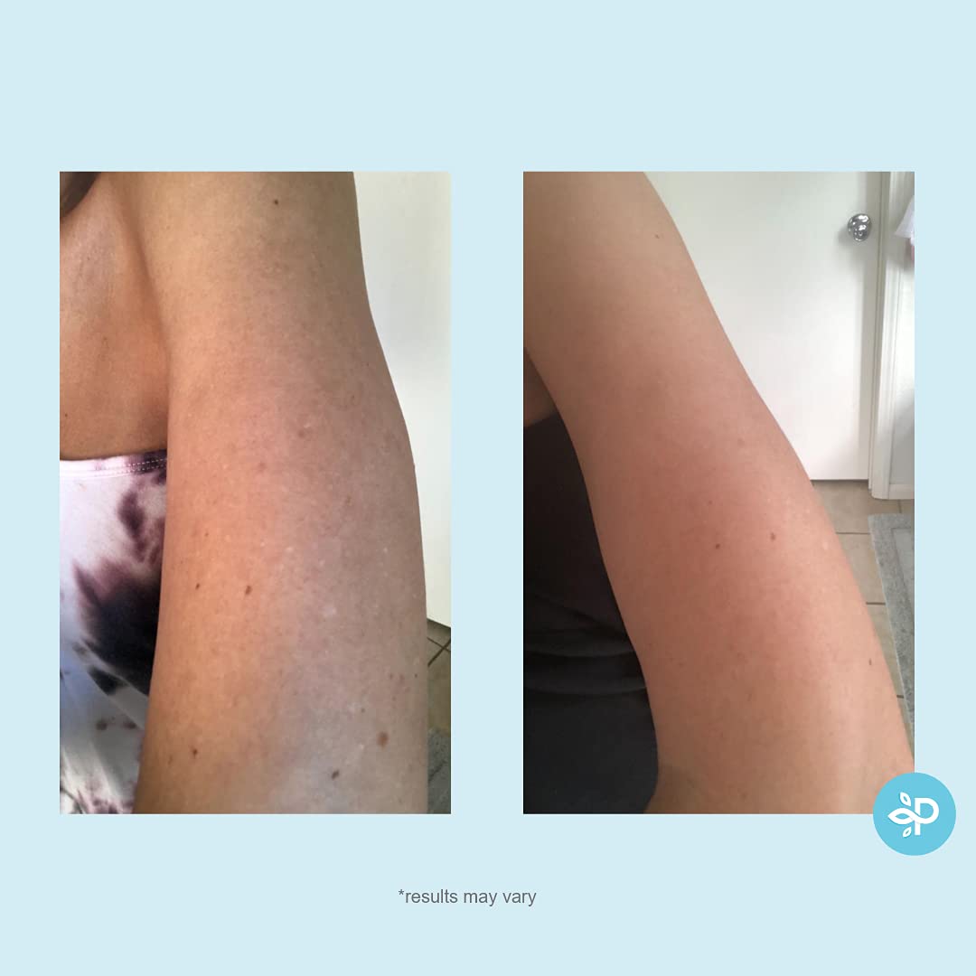 Hydro-Glo Peel Pads - Enhanced with Kojic, Mandelic, Glutathione, Licorice, Papaya, Pineapple, Bearberry Extracts (10% Strength Peel)-FemmiqueWomen