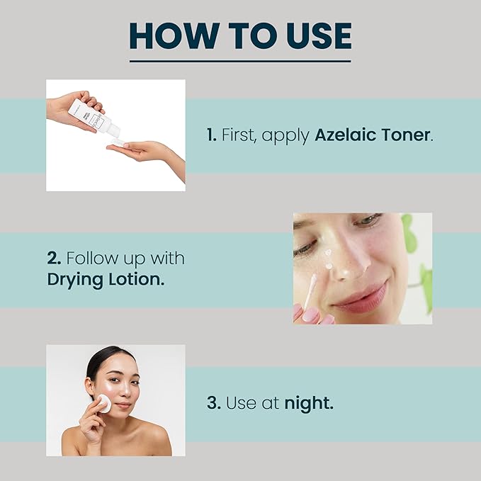 Azelaic Toner & Drying Lotion Duo - Face Treatment Set for Rosacea & Cystic Acne, Soothing Redness Relief, Shrinks Whiteheads & Pores | Normal to Oily Skin-FemmiqueWomen
