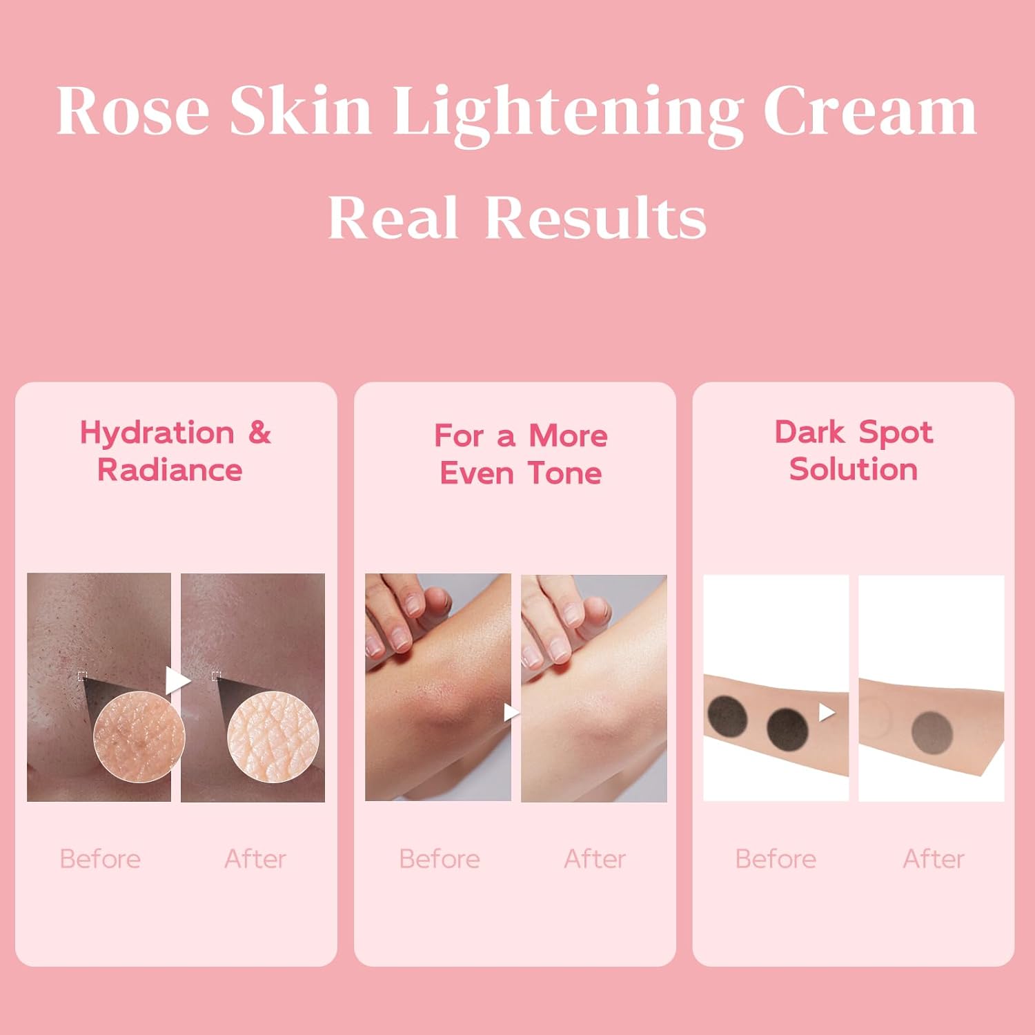 Underarm Lightening Cream - Skin Lightening Cream - Intimate Areas, Inner Thigh, Armpit, Dark Elbows and Knees, Bikini Areas, Underarm, Private Parts, 1.69 fl.oz-FemmiqueWomen