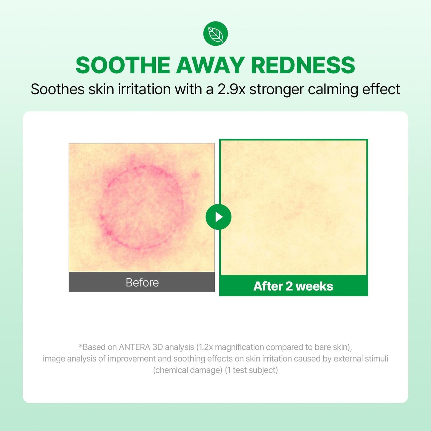 MAKE P:REM INTECA Soothing Cream, Quick Calming Facial Cream with Advanced CICA for Acne-Prone Skin, All Skin Types, EVE VEGAN, Korean Skin Care, 2.70 fl.oz., 80ml-FemmiqueWomen