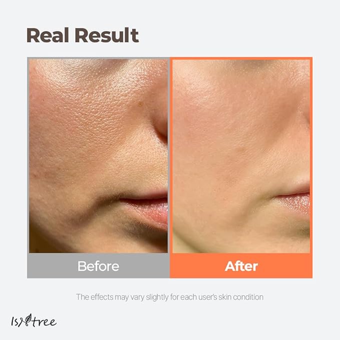 ISNTREE Green Tea Fresh Toner 200ml, 6.76 fl.oz | Korean Skincare | Toner for Oily Skin | Sebum Control | Hydrating and Refreshing-FemmiqueWomen