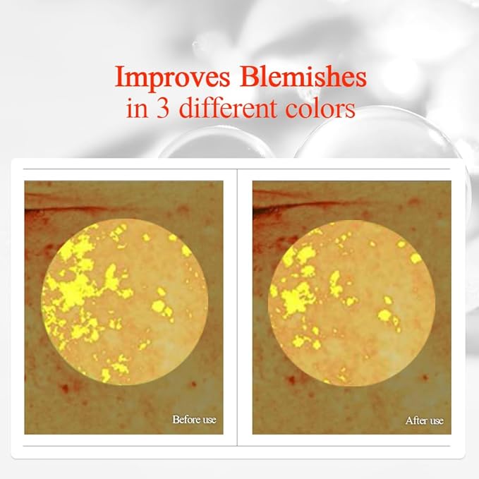 Pyunkang Yul PKY Radiance Vita Toner for Flawless and Radiant Skin, Blemish Care Toner with Vitamin C & Niacinamide, Zero Irritation, Korean Skincare (5.07 Fl. Oz, 150ml)-FemmiqueWomen