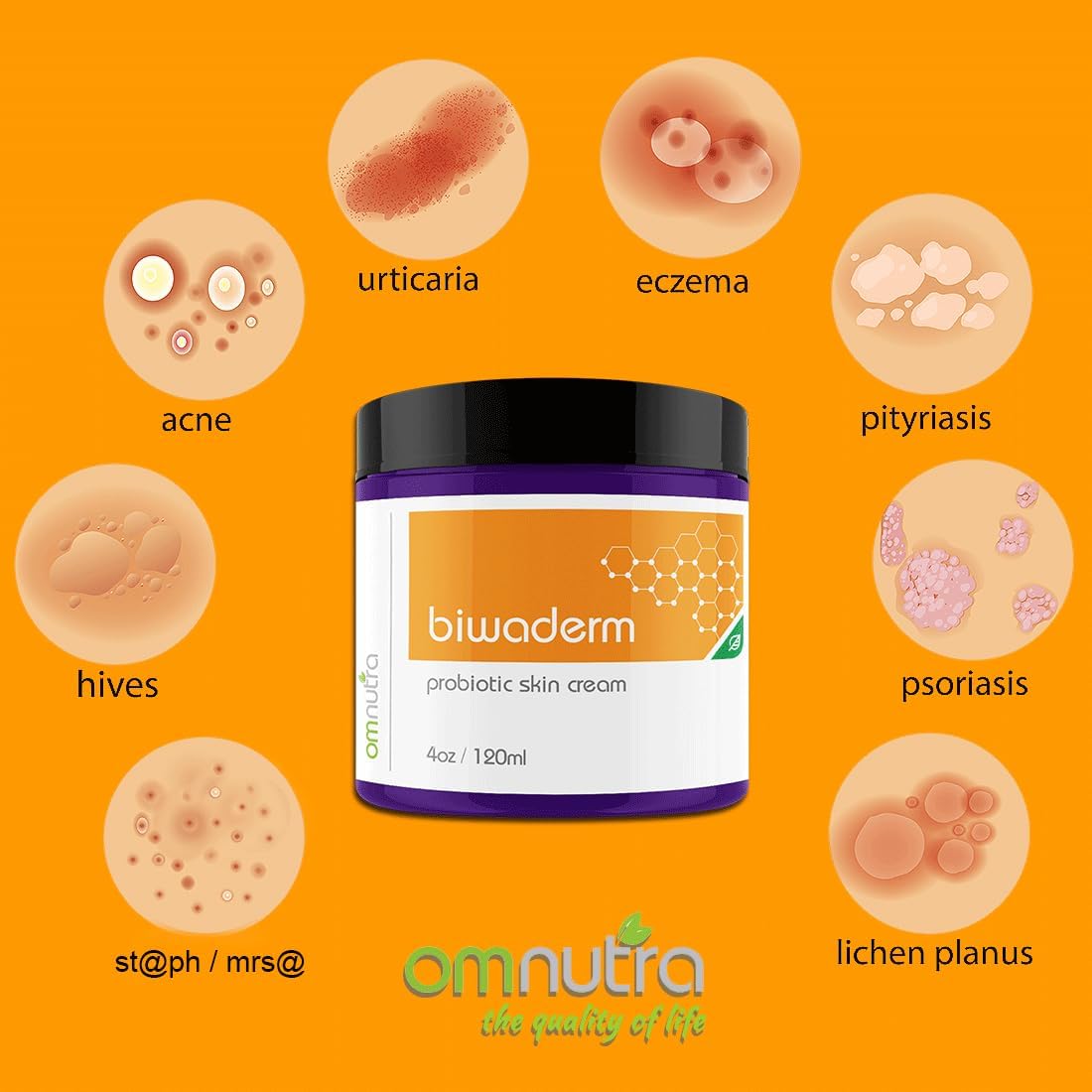 Biwaderm Probiotic Skin Cream - 4OZ Organic Based Topical Probiotics for Skin Care Eczema Treatment Psoriasis Treatment for Folliculitis Treatment Pure Aloe Vera Gel 4oz-FemmiqueWomen