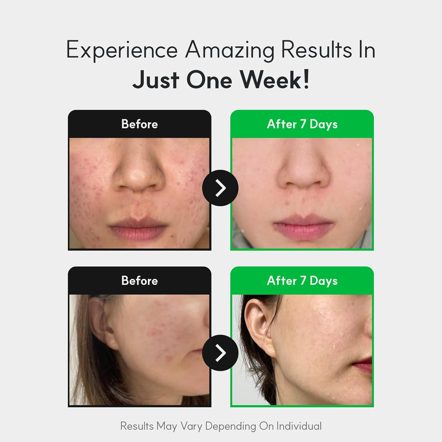 Centelsome 5X Soothing Toner 6.76 fl oz/200ml | Hydrating & Calming Korean Facial Toner with Green Tea, Centella Asiatica & Exosomes | Supports Sensitive, Dry & Acne-Prone Skin-FemmiqueWomen