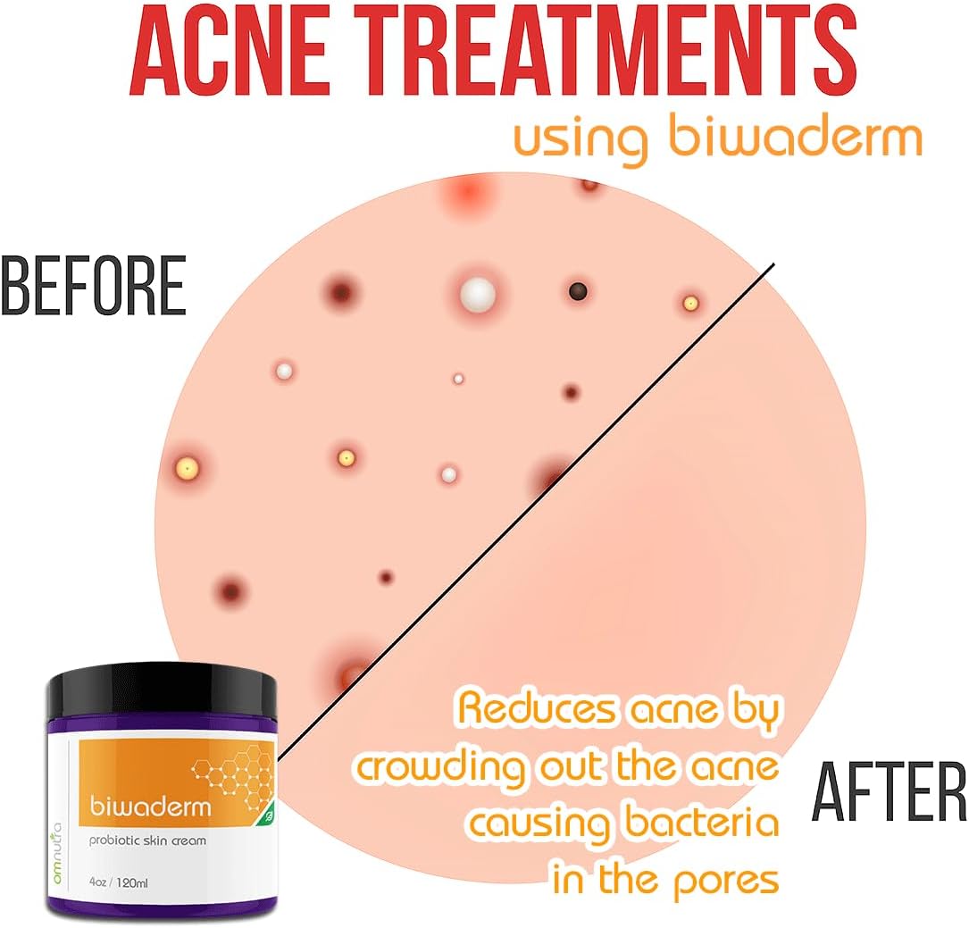 Biwaderm Probiotic Skin Cream - 4OZ Organic Based Topical Probiotics for Skin Care Eczema Treatment Psoriasis Treatment for Folliculitis Treatment Pure Aloe Vera Gel 4oz-FemmiqueWomen