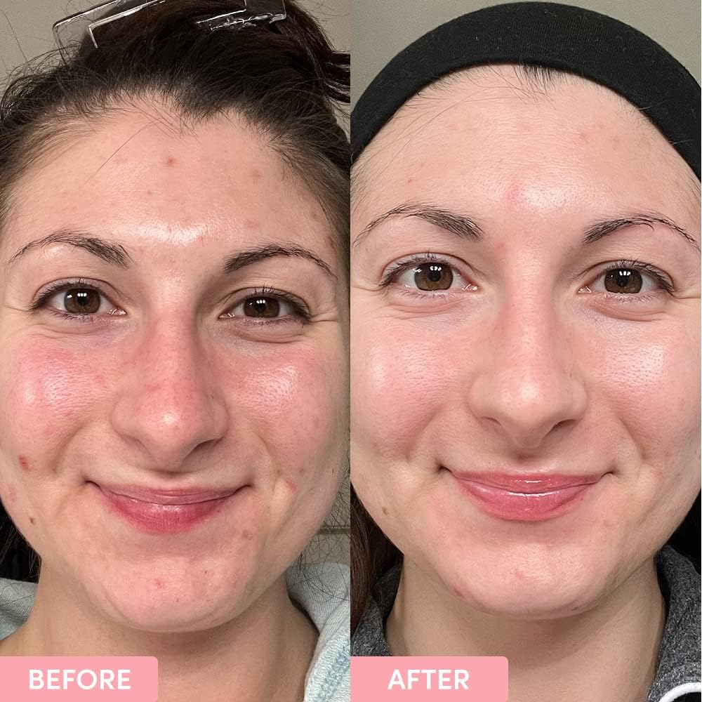 Sand & Sky Australian Essentials Brightening Toner with Niacinamide & Glycolic Acid - Marshmallow Extract Essence, Exfoliates & Strengthens Skin, 4.2 fl oz-FemmiqueWomen