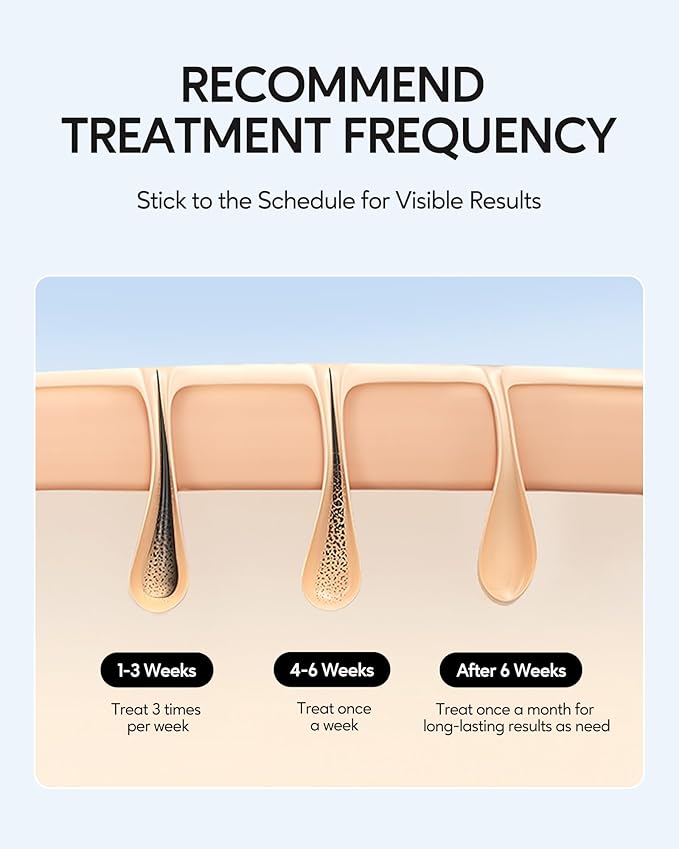 INNZA IPL Hair Removal with Ice Cooling Care Function for Women,Long-Lasting Results,999,999 Flashes Painless IPL Hair Remover, Hair Removal Device for Armpits Legs Arms Bikini Line-FemmiqueWomen