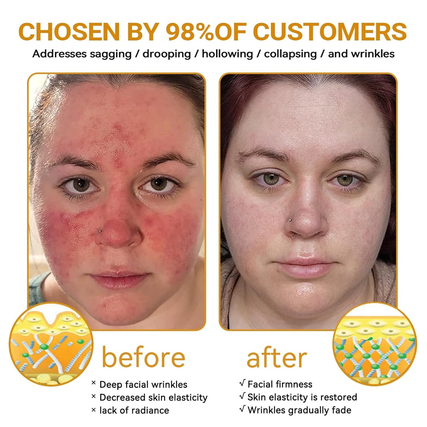 Bee Venom Skin Restoration Cream, Bee Venom Skin Treatment Cream, Repair skin and Firming, Effective In Reducing Blemishes (4)-FemmiqueWomen