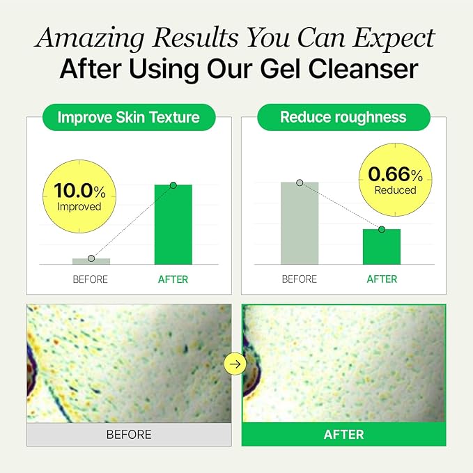 Gel Cleanser, Big Size, Gentle Exfoliation and Face cleanser for Sensitive Skin, Korean Skin Care, Vegan, 6.93 Fl Oz-FemmiqueWomen