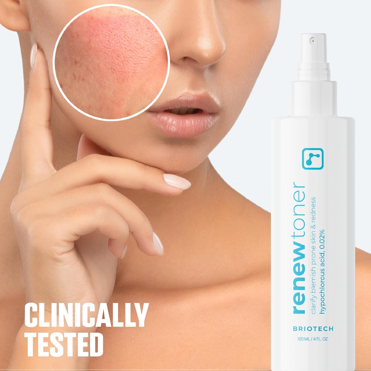 BRIOTECH Renew Toner, Hypochlorous Acid Spray, Minimize Appearance of Blemishes, Soothing Facial Mist for Sensitive Skin, Calm Redness & Bumps, Vegan, 2 fl oz Travel Size (2 Pack)-FemmiqueWomen