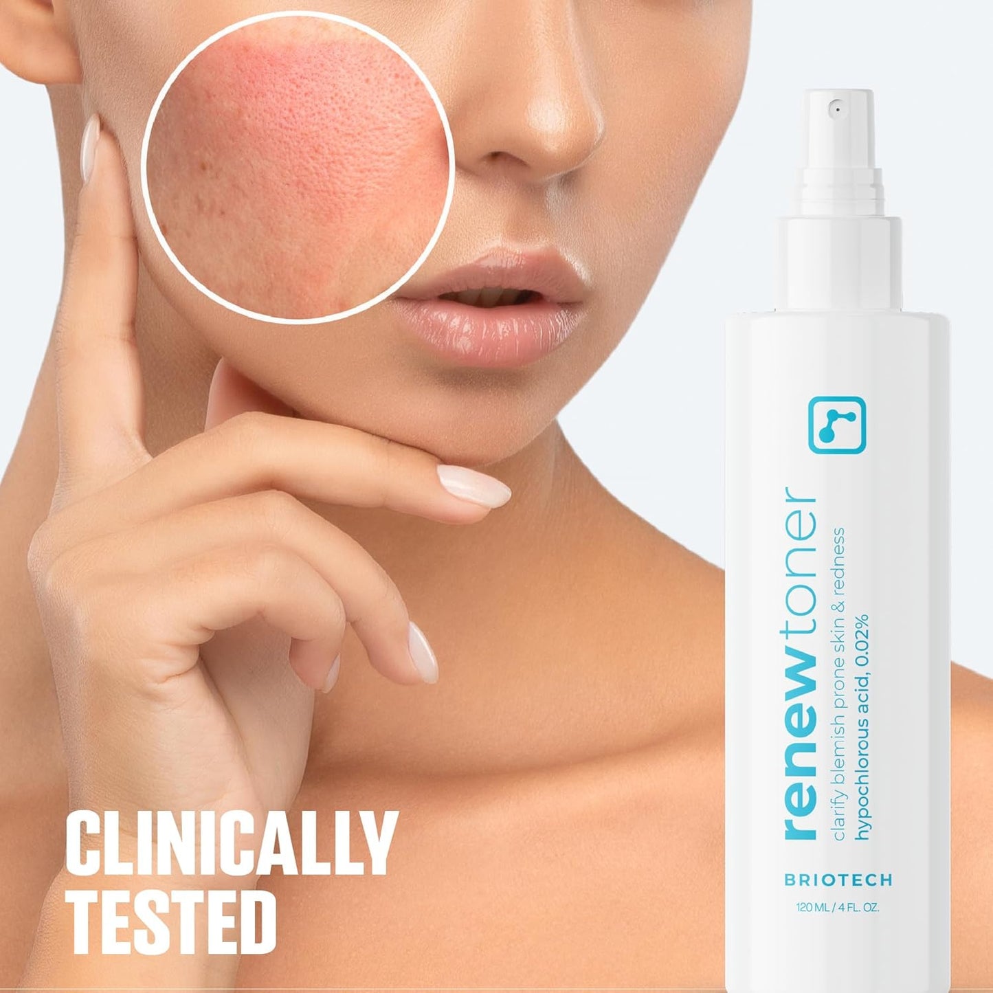 BRIOTECH Renew Toner, Hypochlorous Acid Spray, Minimize Appearance of Blemishes, Soothing Facial Mist for Sensitive Skin, Calm Redness & Bumps, Vegan, 4 fl oz (4 Pack)-FemmiqueWomen