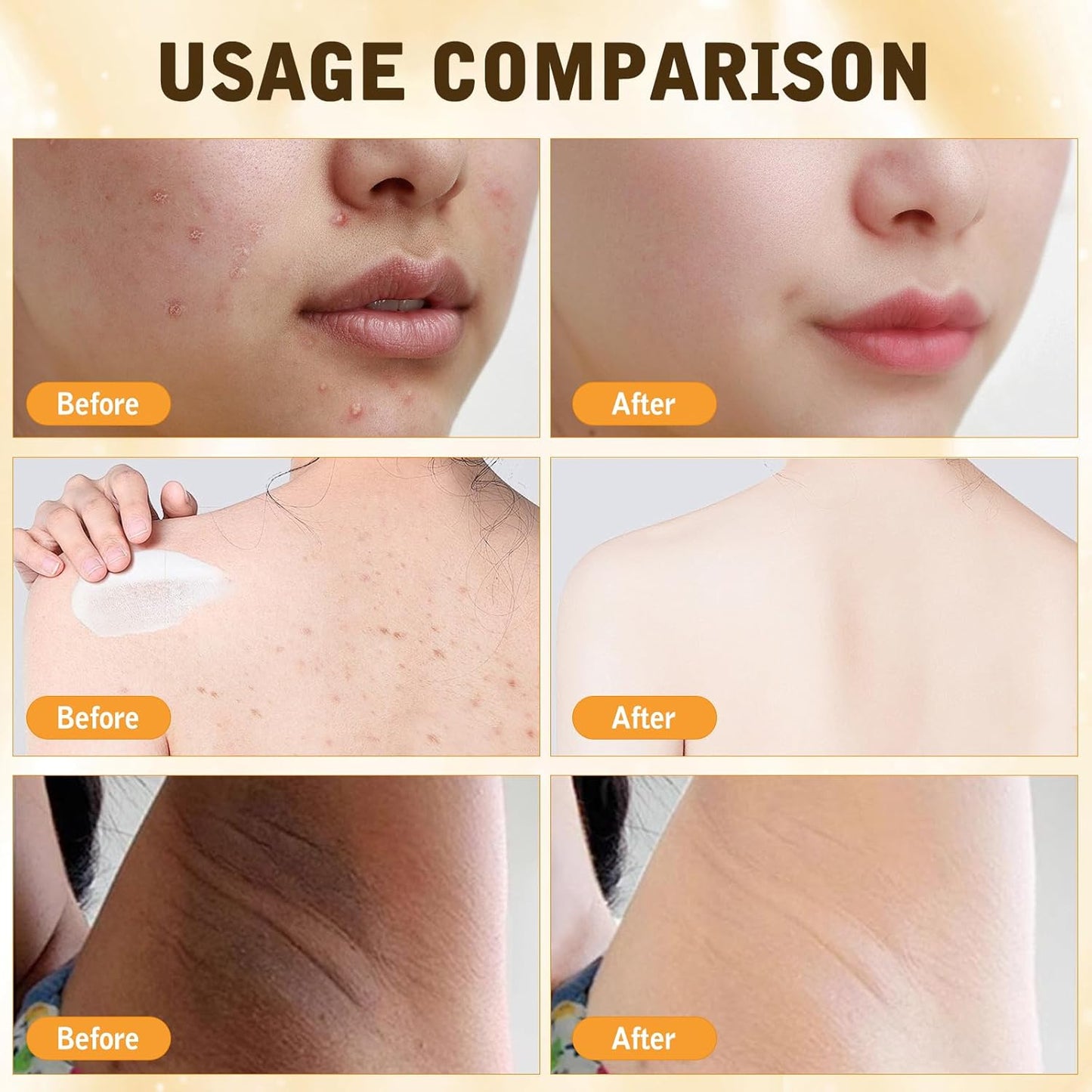 Bee Venom Comprehensive Cream, Firming & Wrinkle-Reducing Deeply Nourishes The Skin, Professional Bee Venom Skin Cream, Natural Serum for All Skin Types (2pcs)-FemmiqueWomen