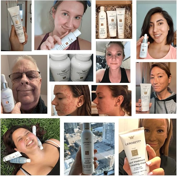 LEROSETT Toner for Clear Skin Aloe Vera Based Toner with Glycolic Acid & 10 Calming Botanicals Helps Reduce Irritation, Future Blemishes, Blackheads, and Tightens Pores, Natural, Vegan - 4 oz-FemmiqueWomen