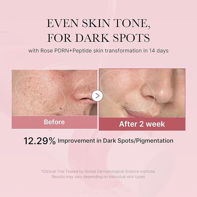 medicube PDRN Pink Peptide Toner I Pink Glow Toner for Skin Boosting, Soothing and Calming, Uneven Skin Tone, Rose PDRN & Peptide & Niacinamide, Korean Skin Care (250ml / 8.45 fl. oz.)-FemmiqueWomen