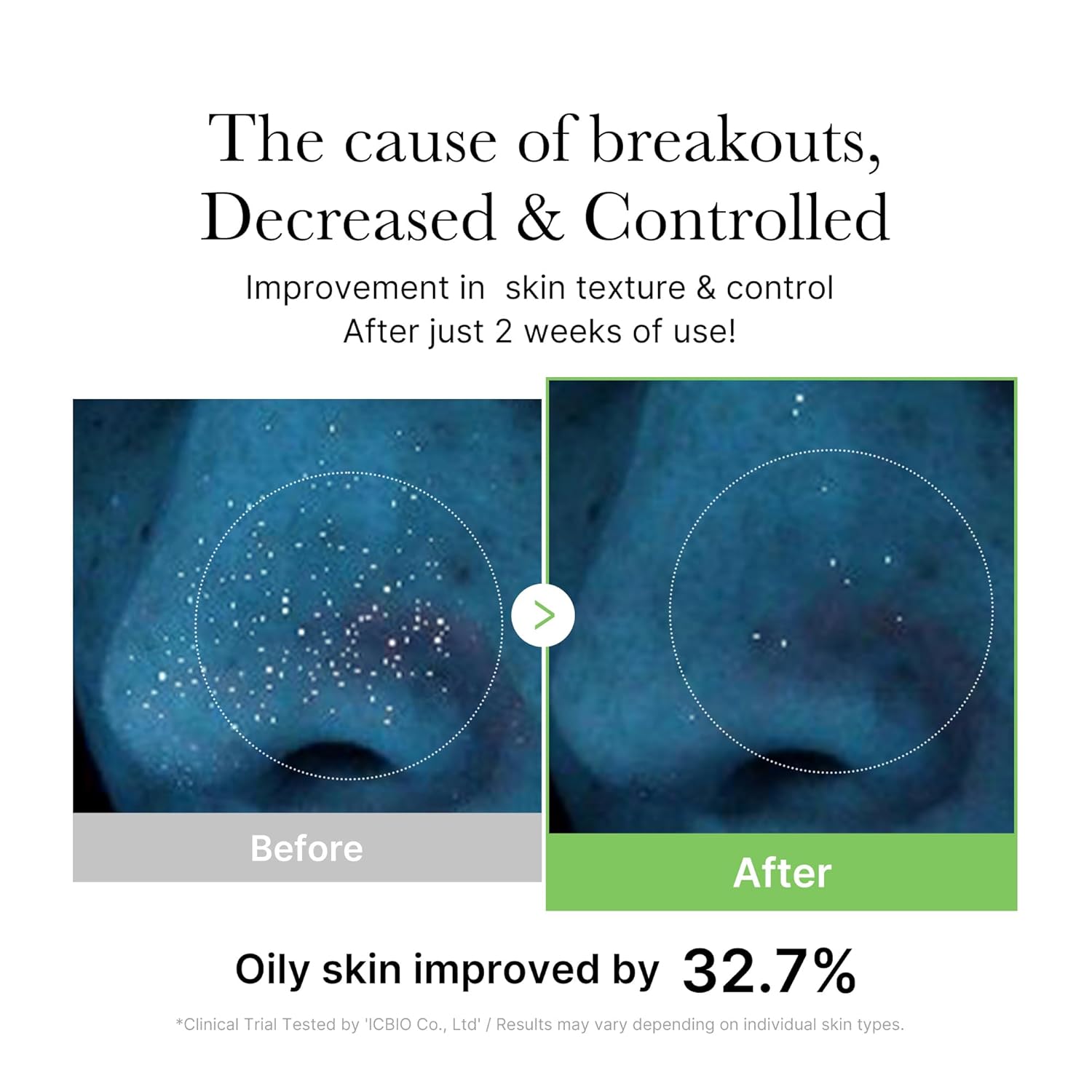 Medicube Exosome Cica Toner | Daily Soothing Toner With Exosome Cica, Heartleaf, Tea Tree, 12 Kinds of Cica | Low Irritation, Sebum care Korean Skin Care, for Stressed Skin (210ml / 7.10 fl.oz.)-FemmiqueWomen