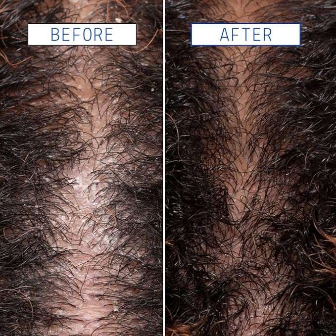 AAVRANI Scalp Detox Jelly Cleanser - Sulfate-Free Clarifying Shampoo - with Glycolic Acid & Vitamin E to Remove Build Up and Excess Oil - Color-Safe - Vegan - 8.4 Fl Oz-FemmiqueWomen