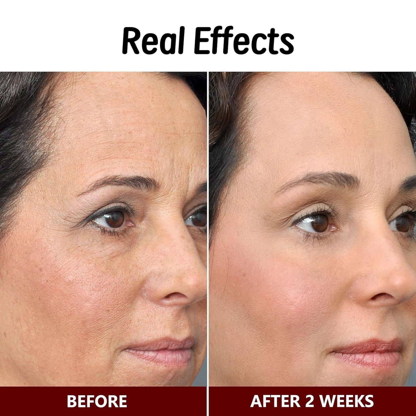 Bee Venom Skin Treatment Cream, Bee Venom Comprehensive Cream, Face lifting and firming, Effective In Reducing Skin Blemishes, Gentle and Non-irritating, Suitable For All Parts 2.1 Ounce (Pack of 1)-FemmiqueWomen