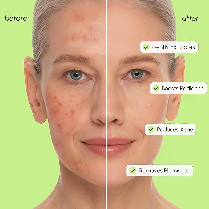 MAREE Exfoliating Toner with Salicylic Acid – AHA BHA Exfoliant & Face Exfoliator Pore Cleaner – BHA Liquid Exfoliant – Sebum Dead Skin Care Remover for Face – Exfoliante Para la Cara Acido Salicilico-FemmiqueWomen