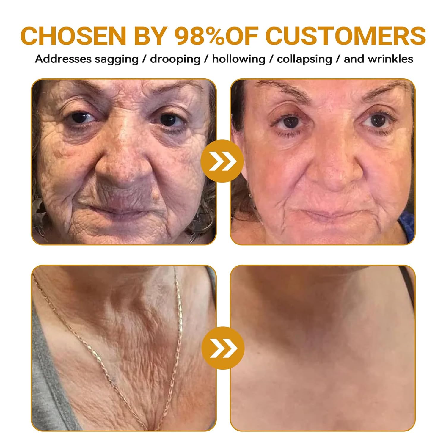 Bee Venom Skin Restoration Cream, Bee Venom Skin Treatment Cream, Repair skin and Firming, Effective In Reducing Blemishes (4)-FemmiqueWomen