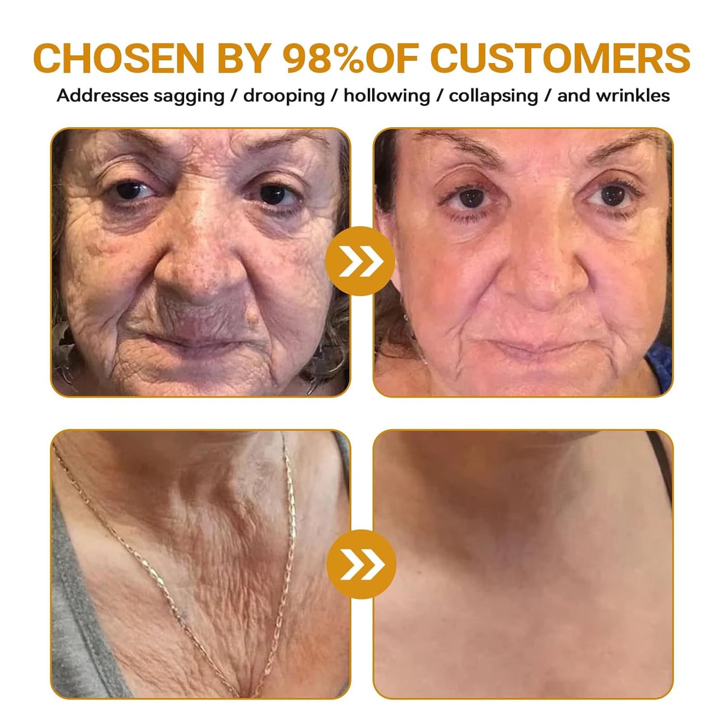 Bee Venom Skin Restoration Cream, Bee Venom Skin Treatment Cream, Repair skin and Firming, Effective In Reducing Blemishes (3)-FemmiqueWomen