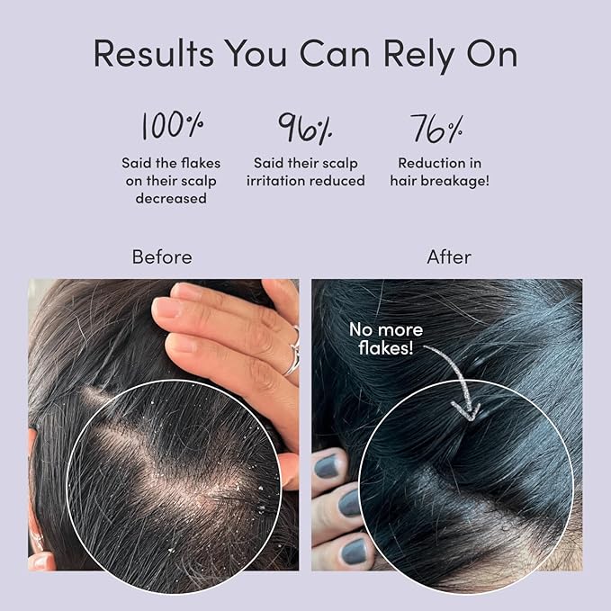 Jupiter Anti-Dandruff Shampoo, Conditioner, & Serum Advanced Set, Physician-Formulated for Dry, Itchy, Oily, Flaky Scalp Care, Color-Safe, Dry Scalp, Sulfate-Free-FemmiqueWomen