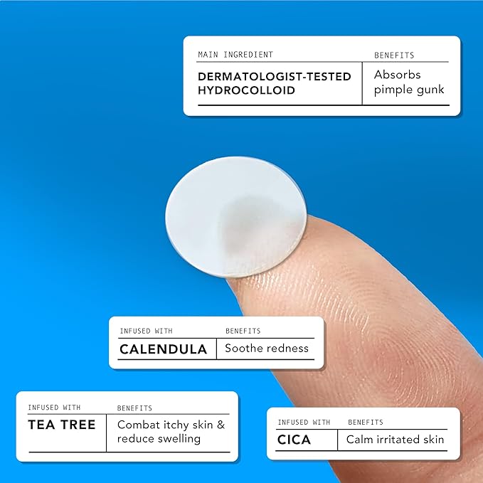 AVARELLE Pimple Patches for Face | Hydrocolloid Acne Patches for Covering Blemishes | FSA HSA Store Eligible Zit Patches with Tea Tree, Calendula, & Cica | (10-14 mm, 300 Count) Bulk Pack