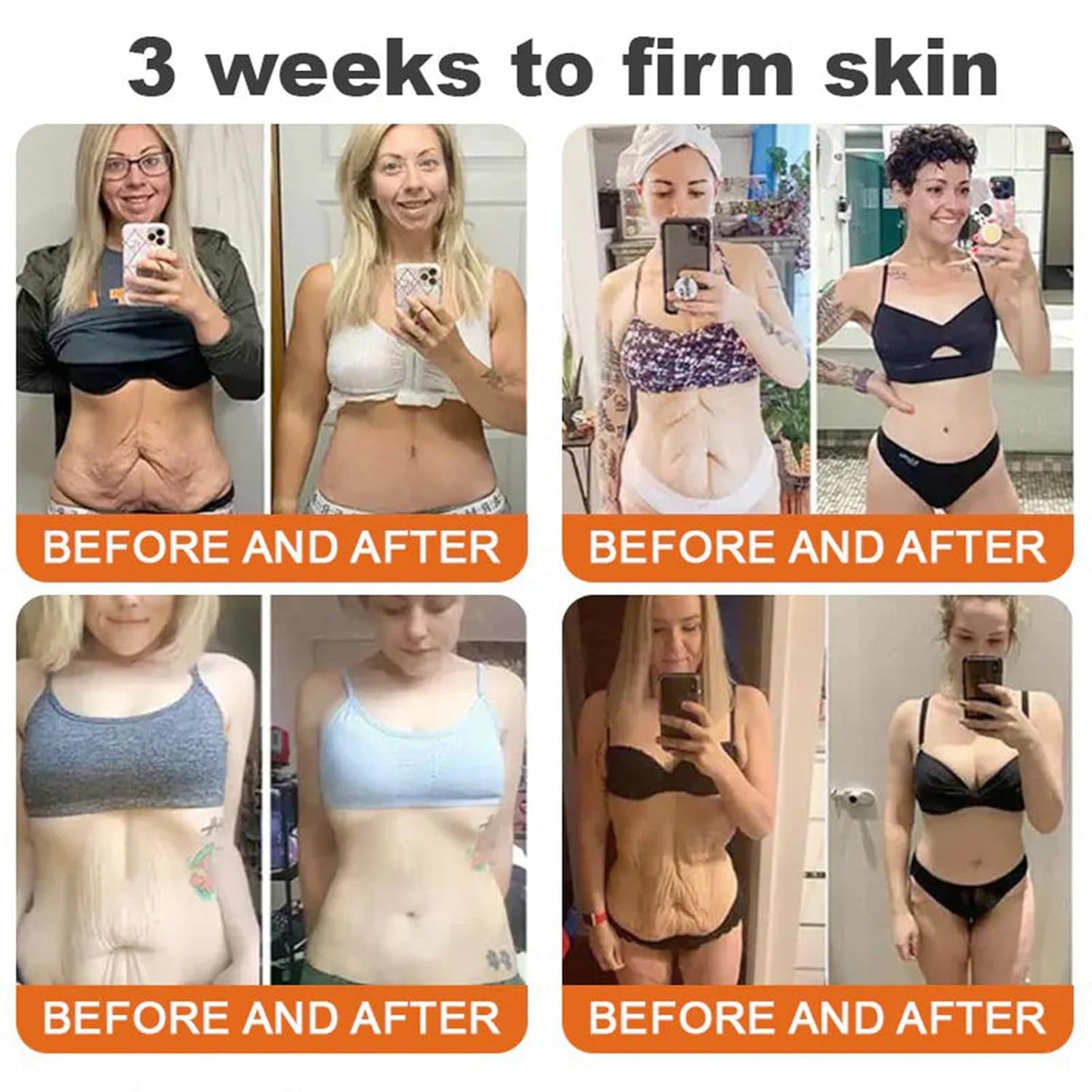 Bee Venom Comprehensive Cream, Professional bee venom cream for Removing and Repair, APKAPK Bee Venom Skin Treatment Cream, Natural Serum Suitable for All Skin Types (2 Pack)-FemmiqueWomen