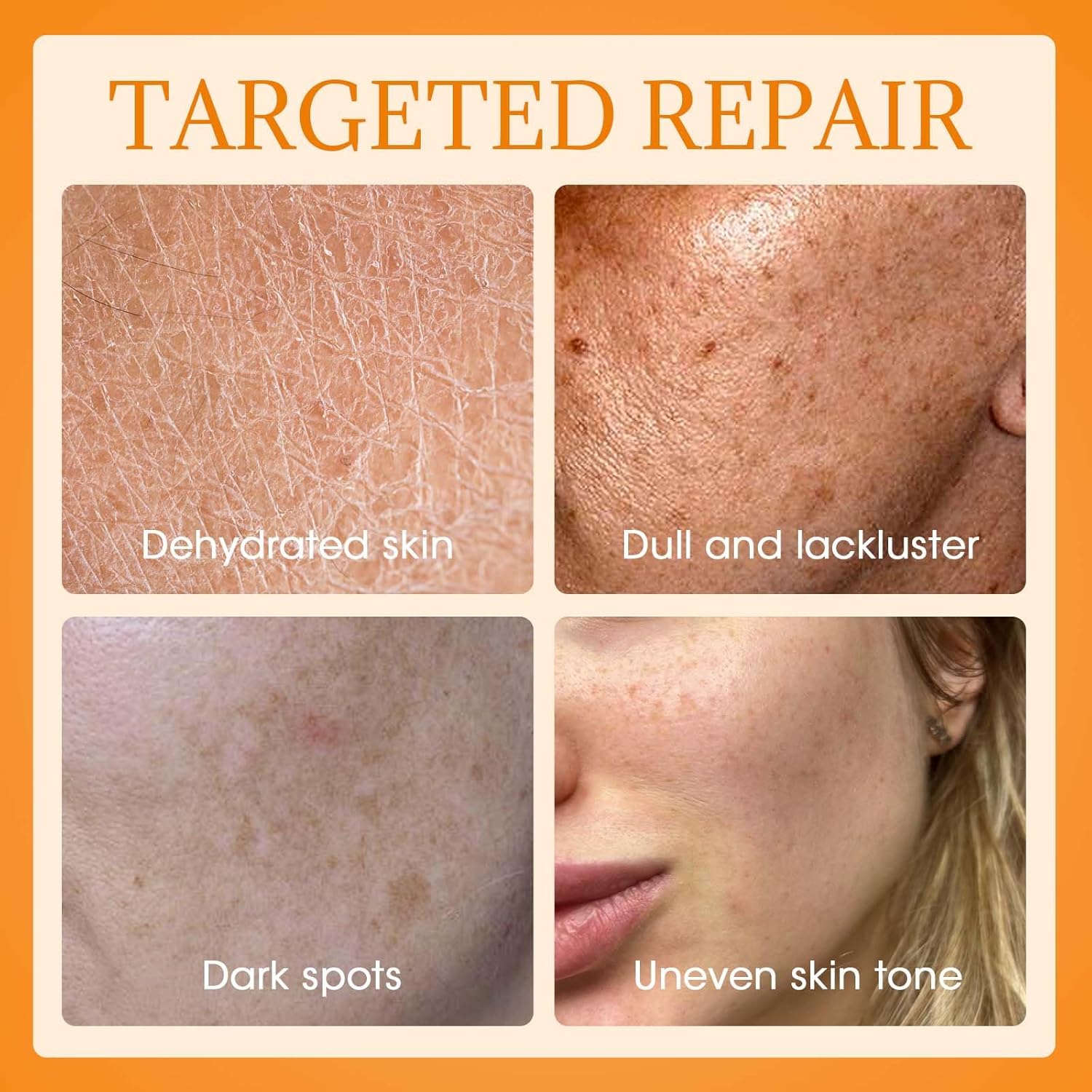 MQ Vitamin C Cream Visibly Brightening Body Lotion | Vitamin C Moisturizer Care Body Cream, Revitalizes Dull-Looking Skin, Promotes A Glowing Complexion-FemmiqueWomen