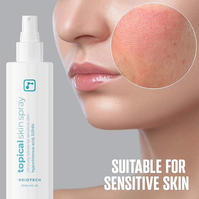 BRIOTECH Topical Skin Spray, Hypochlorous Acid Spray for Sensitive Skin, HOCl Facial Mist, Full Body Support Against Irritation, Calm Redness, Soothe Foot & Scalp, 8 oz (1 Pack)-FemmiqueWomen