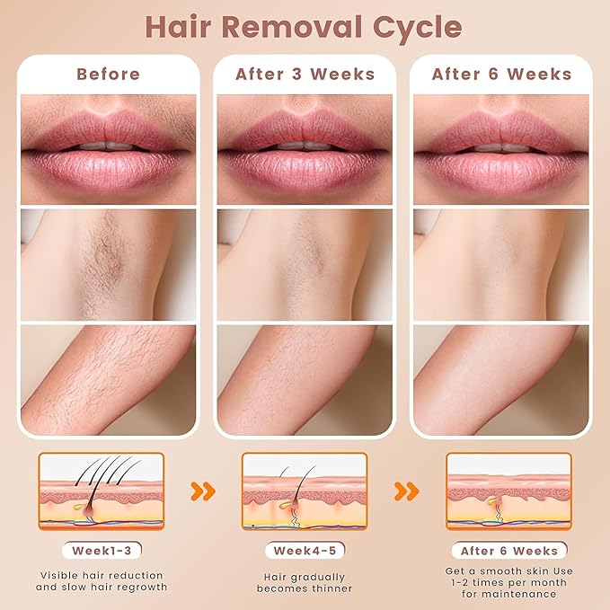IPL Hair Removal Device, Hair Removal Body and Face for Home Use for Armpits Legs Arms Bikini Line,model S3-FemmiqueWomen