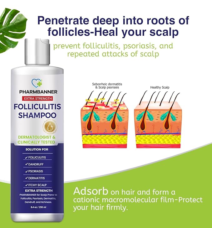 Anti-Fungal Shampoo for Itchy, Dry Scalp – Supports Scalp Health, Helps with Folliculitis, Seborrheic Dermatitis & Scalp Flaking-2 Pack-FemmiqueWomen