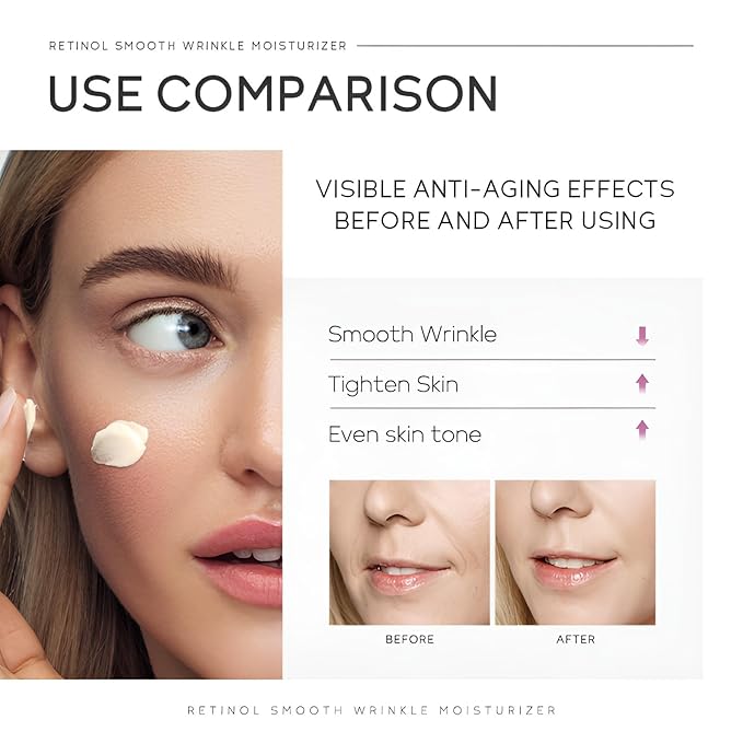 Retinol Cream for Face, Anti Aging Face Moisturizer with Hyaluronic Acid, Rapid Wrinkle Repair, Day & Night Cream Serum for Women, Reduce Fine Lines, Wrinkles & Dark Spots 1.06oz, 2Pack-FemmiqueWomen