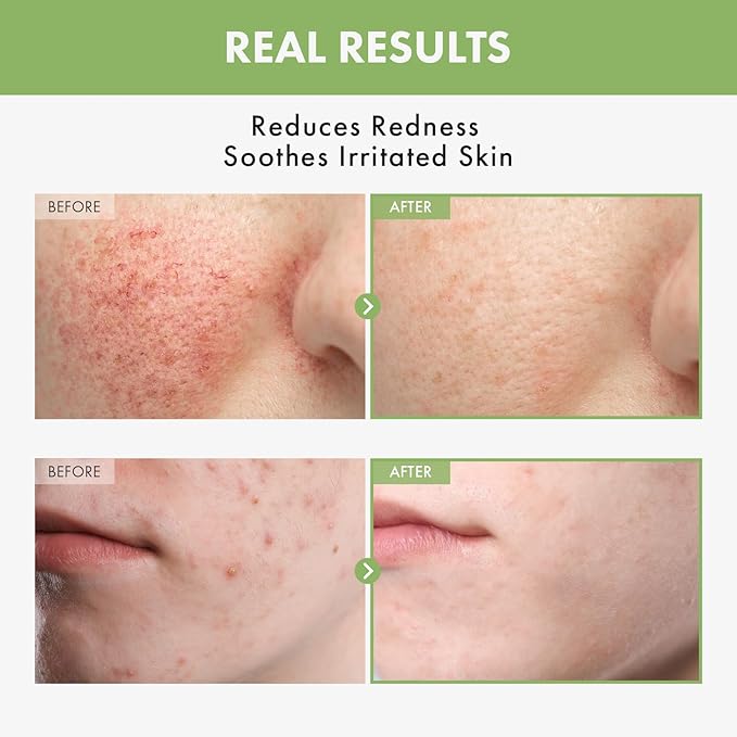 Heartleaf Face Toner with 970,200ppm Heartleaf Water, Centella, Hyaluronic Acid, Witch Hazel, Trouble Care, Acne-Prone, Calming, Hydrating, Purifying, Korean Skin Care, 250ml, 8.45 fl.oz.-FemmiqueWomen