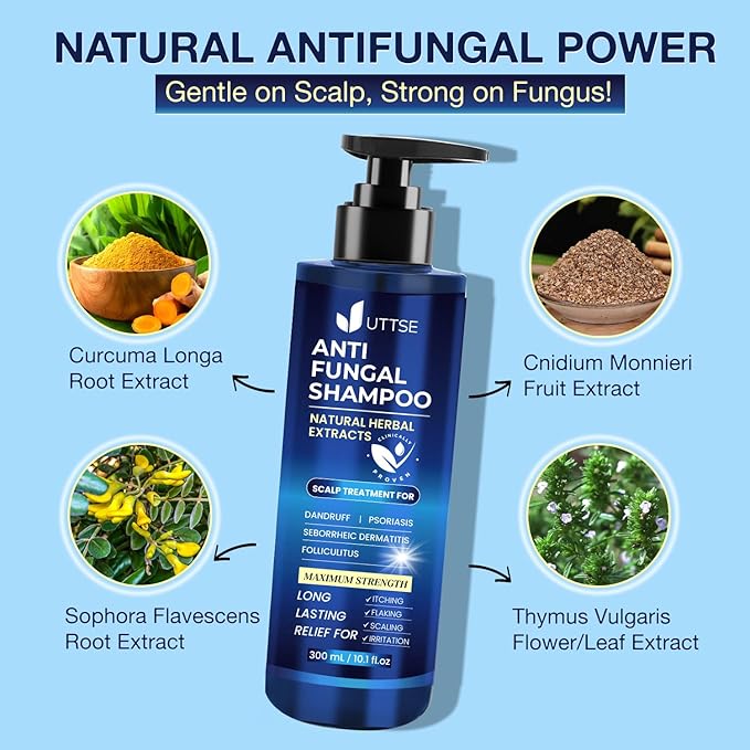 Anti-Fungal Shampoo for Scalp Psoriasis: Dandruff Shampoo for Folliculitis and Seborrheic Dermatitis - Relieves Itchy & Dry Scalp - 300 mL / 10.1 fl.oz-FemmiqueWomen