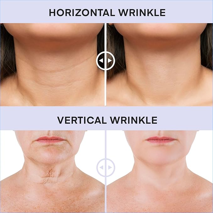 Neck Tightening Cream, Neck Firming Cream For Tightening and Firming, Fine lines, Loose & Sagging On Face, Decollete & Other Skin Areas - 1.7 OZ-FemmiqueWomen