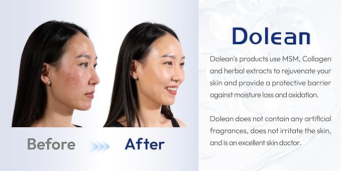 Relaxing Mist Facial Spray With Msm And Collagen, Face Mist Hydrating And Redness Remedy,No Artificial Fragrance, Body/Skin Care, 4 Fl Oz-FemmiqueWomen