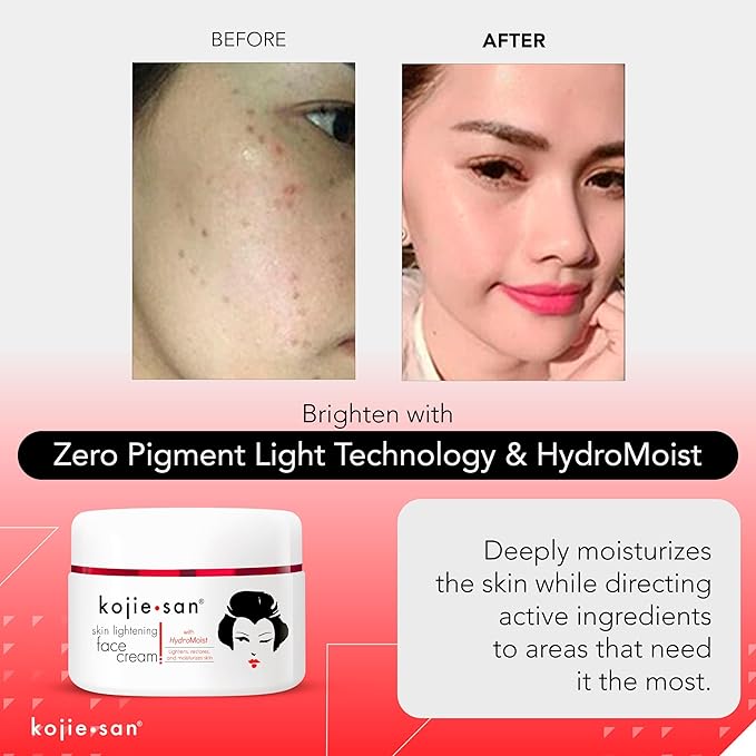 Kojie San Face & Body Complete Brightening Mini Set - 65 Gram x 2 Bars Soap, Body Lotion, Face Cream, and Facial Cleansing Brush-FemmiqueWomen