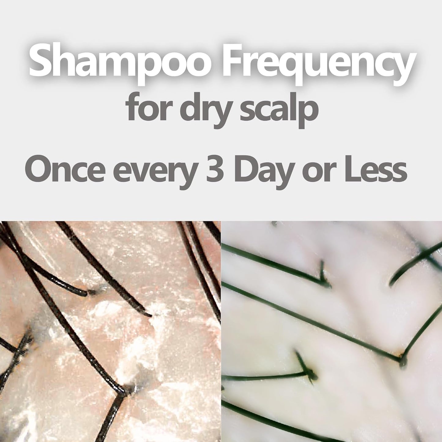 Aromase Dry Scalp Soothing Shampoo - Hydrates, Relieves Dryness and Itchiness - Amino Acid-Based Formula - No Parabens, SLS, or Silicone - 14 oz-FemmiqueWomen