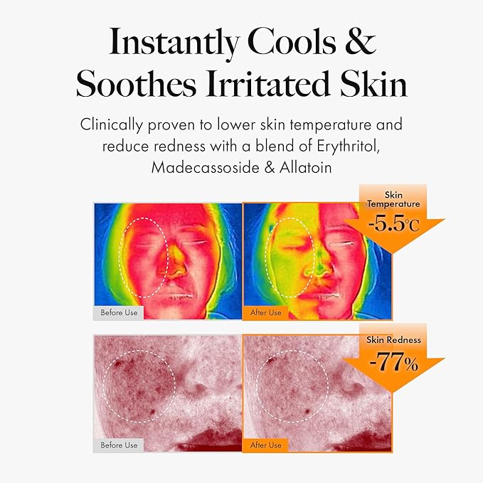 MASTINA Mastic Face Spray (1.69fl oz) Facial Mist for Natural Glow, Hydrating Formula for Dry Skin, On-the-Go Portable Korean Skin Care, Travel Summer Essentials. Mastic Gum.-FemmiqueWomen