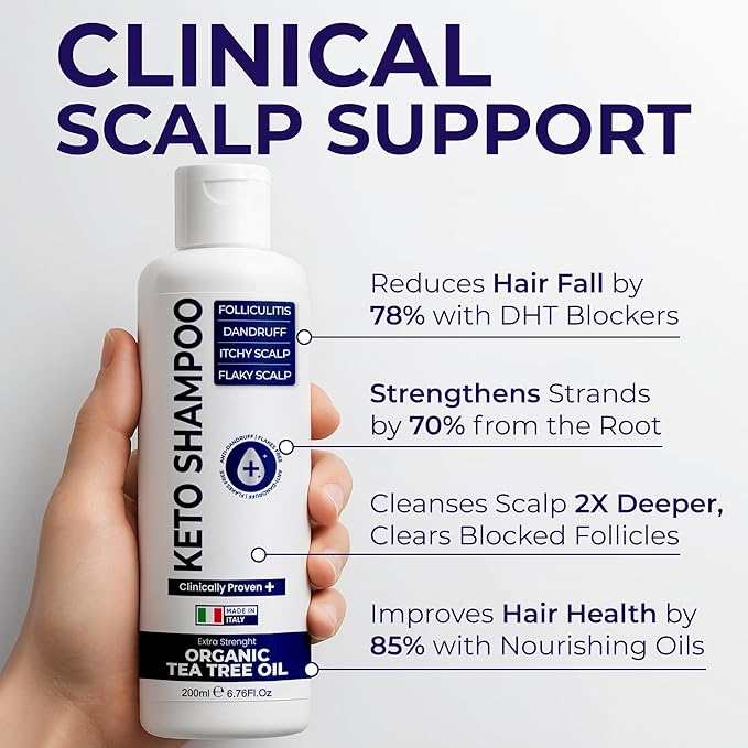 Scalp Psoriasis Shampoo, Flakes Shampoo Anti Dandruff, Itchy Scalp Treatment for Seborrheic Dermatitis & Folliculitis, Anti Fungal, Medicated Solution for Itchy, Flaky & Dry Hairs-FemmiqueWomen