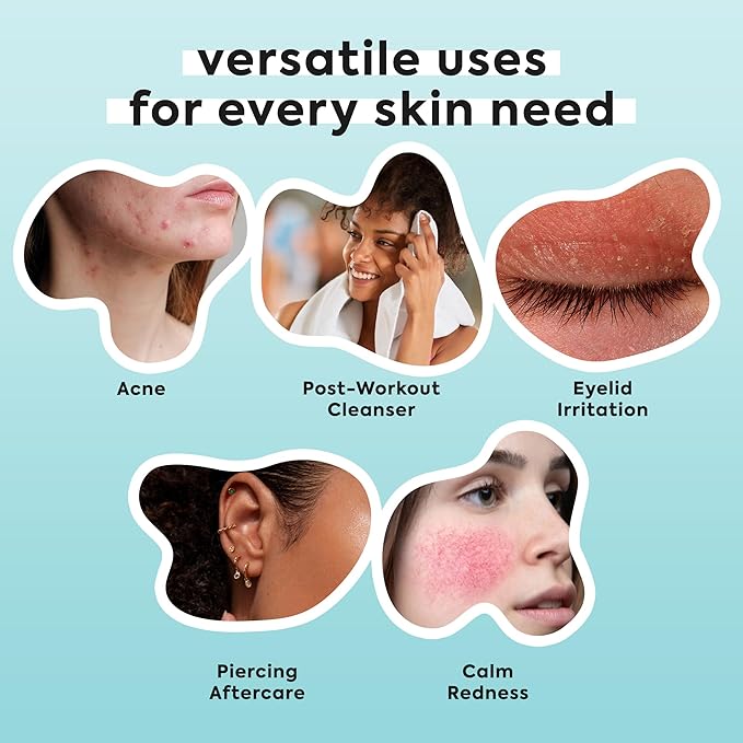 Hypochlorous Acid Spray for Face & Body - Helps Reduce Redness and Breakouts - Travel Size Hypochlorous Spray, Multi-Purpose Topical Facial Skin Repair, pH-Balancing Toner - TSA, Livaclean-FemmiqueWomen