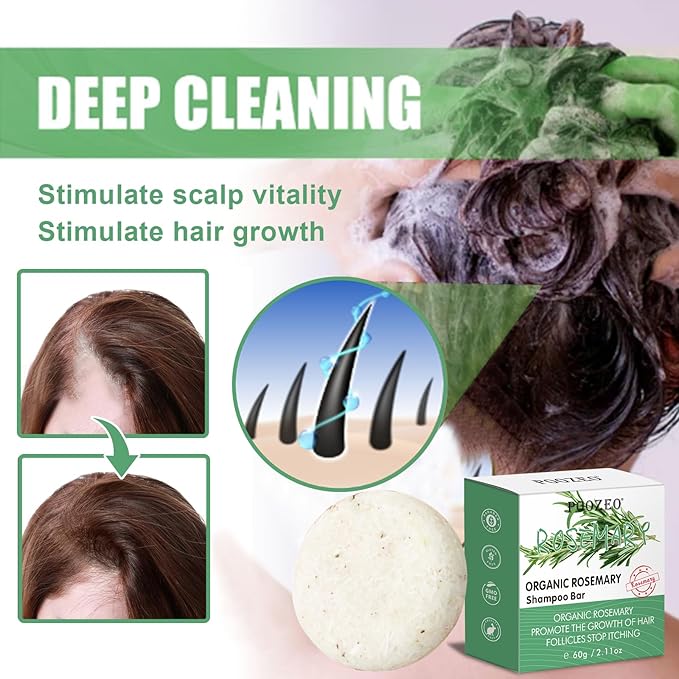 2 Pack Rosemary Shampoo Conditoner Bar Set,Thinning Hair-Volume Shampoo & Conditioner Bar for Men and Women,Hair Thickening & Regrowth Treatment,Hair Growth Soap for Anti-Hair Loss-FemmiqueWomen