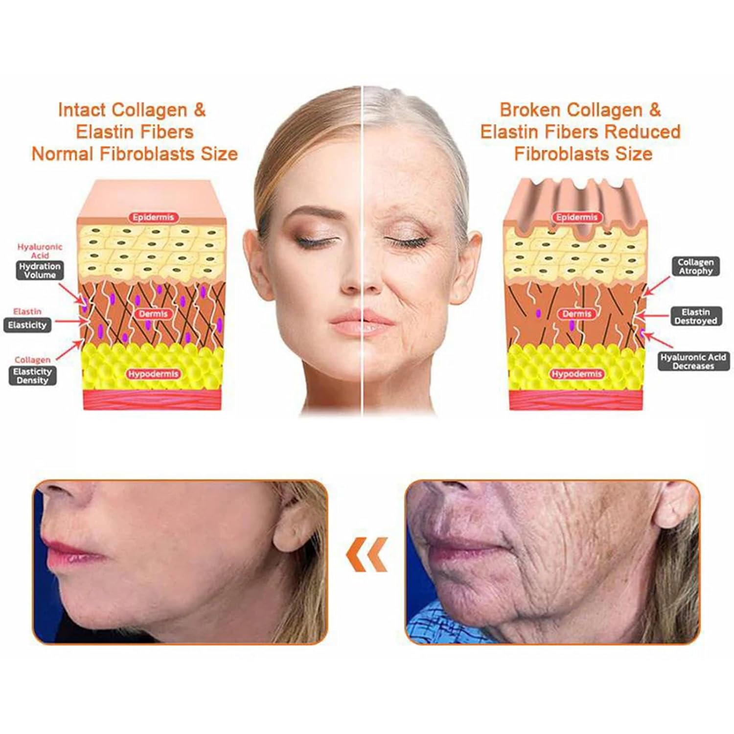 Bee Venom Comprehensive Cream, Professional bee venom cream for Removing and Repair, APKAPK Bee Venom Skin Treatment Cream, Natural Serum Suitable for All Skin Types (4 Pack)-FemmiqueWomen