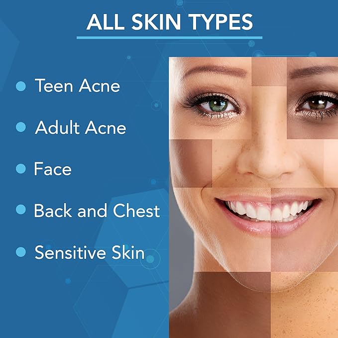 NOVEHA Facial Cleanser For Acne - Hypochlorous Acid Spray - Irritation, Redness & Breakouts Relief - Ideal for Active Teenage & Adult Athletes Post-Workout - Safe for Multiple Daily Uses - 8 oz-FemmiqueWomen