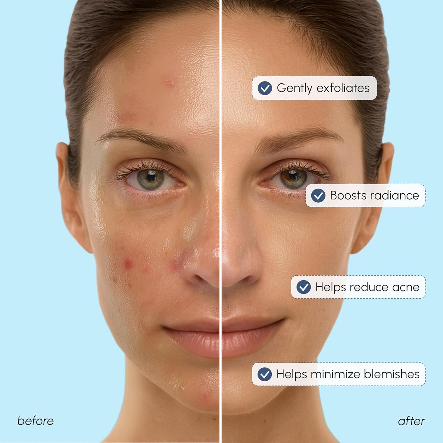 MAREE Glycolic Acid Toner 10% Facial Polish - Exfoliating Toner for Face - Glycolic Acid Toning Solution - Face, Scalp & Underarms Exfoliant Spray Alternative - Pure Acido Glicolico para Manchas-FemmiqueWomen