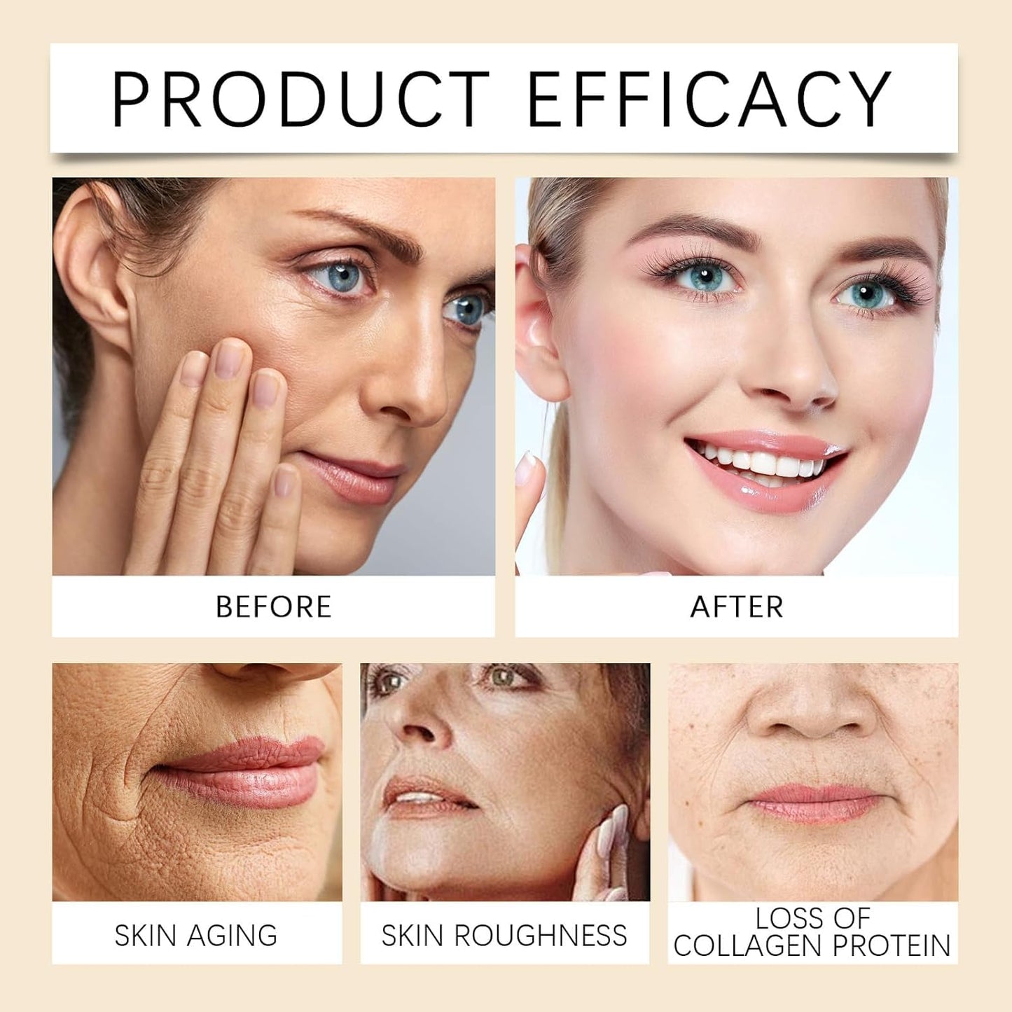 Bee Venom Wrinkle Removal Cream, Anti-Aging, Restore and Enhance Skin Elasticity, Natural and Non-Irritating, Suitable for Sensitive, Dry, Oily Skin-FemmiqueWomen