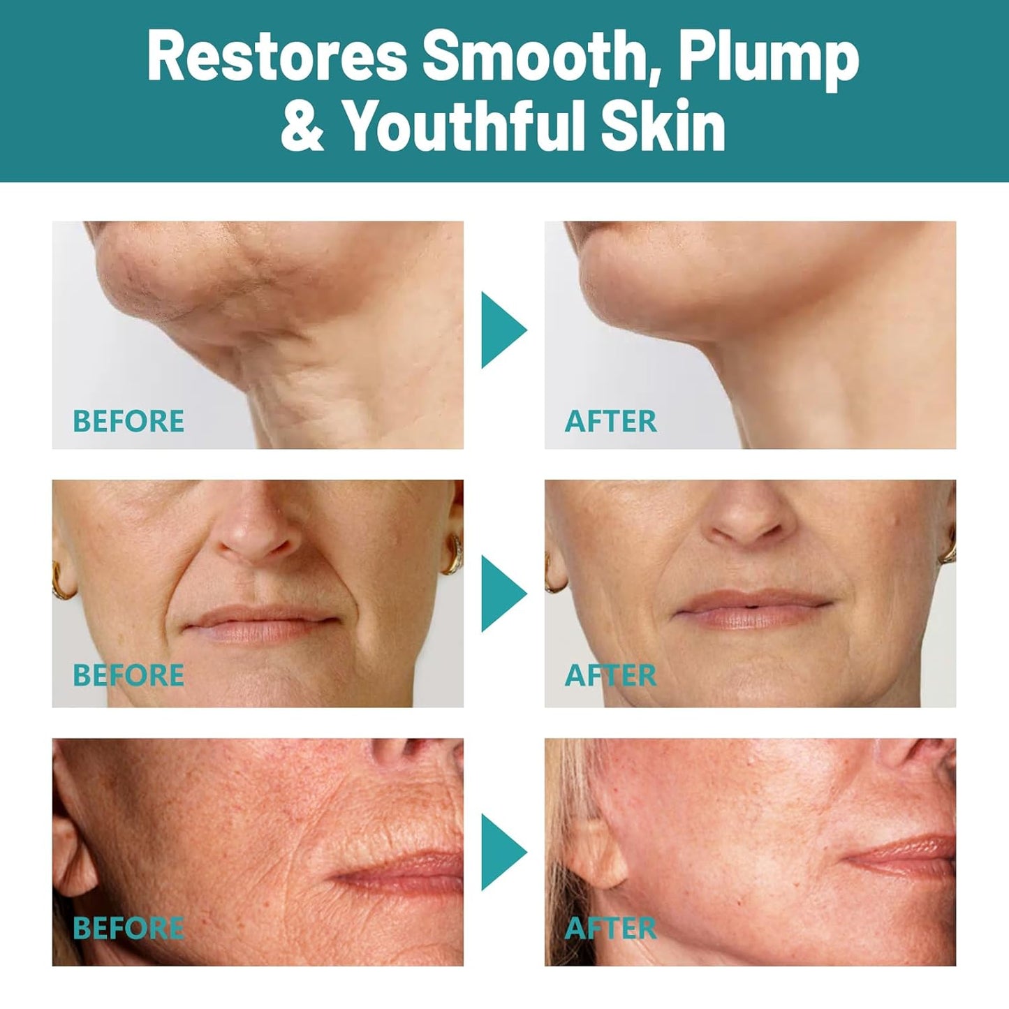 Crepes skin cream for aging skin ,Crepes Skin Repair Treatment, Firming Cream with Hyaluronic Acid & Shea Butter to Deeply Moisturize & Tighten Wrinkly Dry-FemmiqueWomen