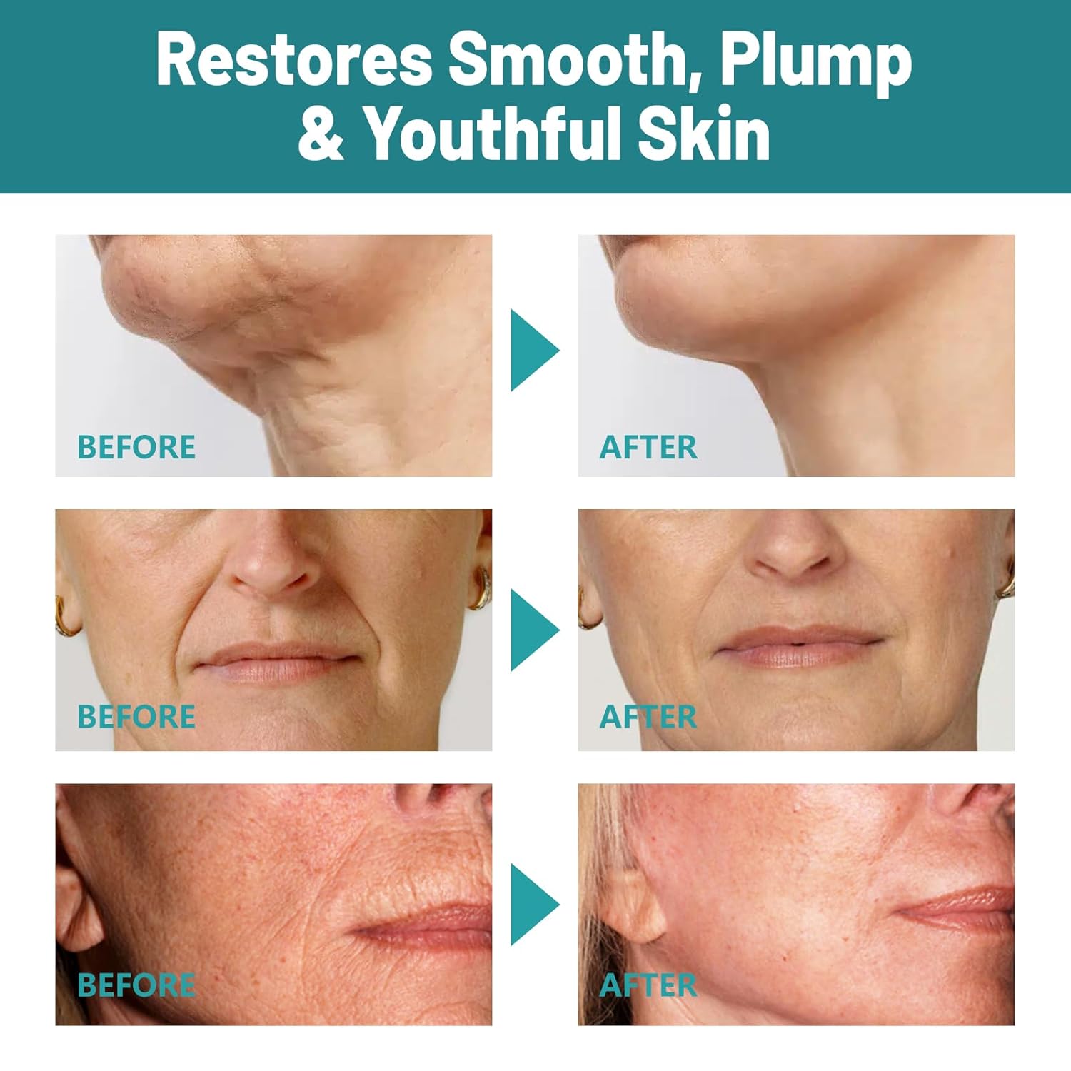 Crepes skin cream for aging skin ,Crepes Skin Repair Treatment, Firming Cream with Hyaluronic Acid & Shea Butter to Deeply Moisturize & Tighten Wrinkly Dry-FemmiqueWomen