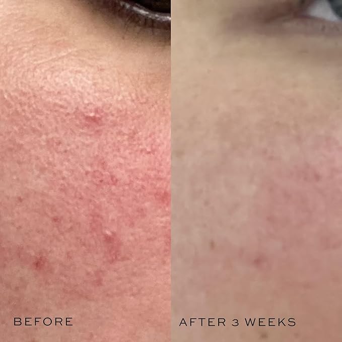 DIME Beauty Mini Super Skin Toner, Alcohol-Free Witch Hazel Toner, Travel-Size Toner with Cucumber Extract, 2 oz / 60 ml-FemmiqueWomen